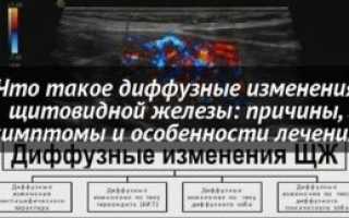 Диффузные изменения щитовидной железы с узлообразованиями