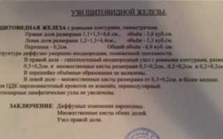 УЗИ щитовидной железы что означает?
