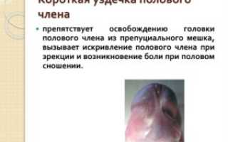 На половину светлая головка полового члена